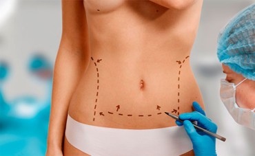 ¿Qué pasa si no usas una faja de calidad después de una cirugía estética?